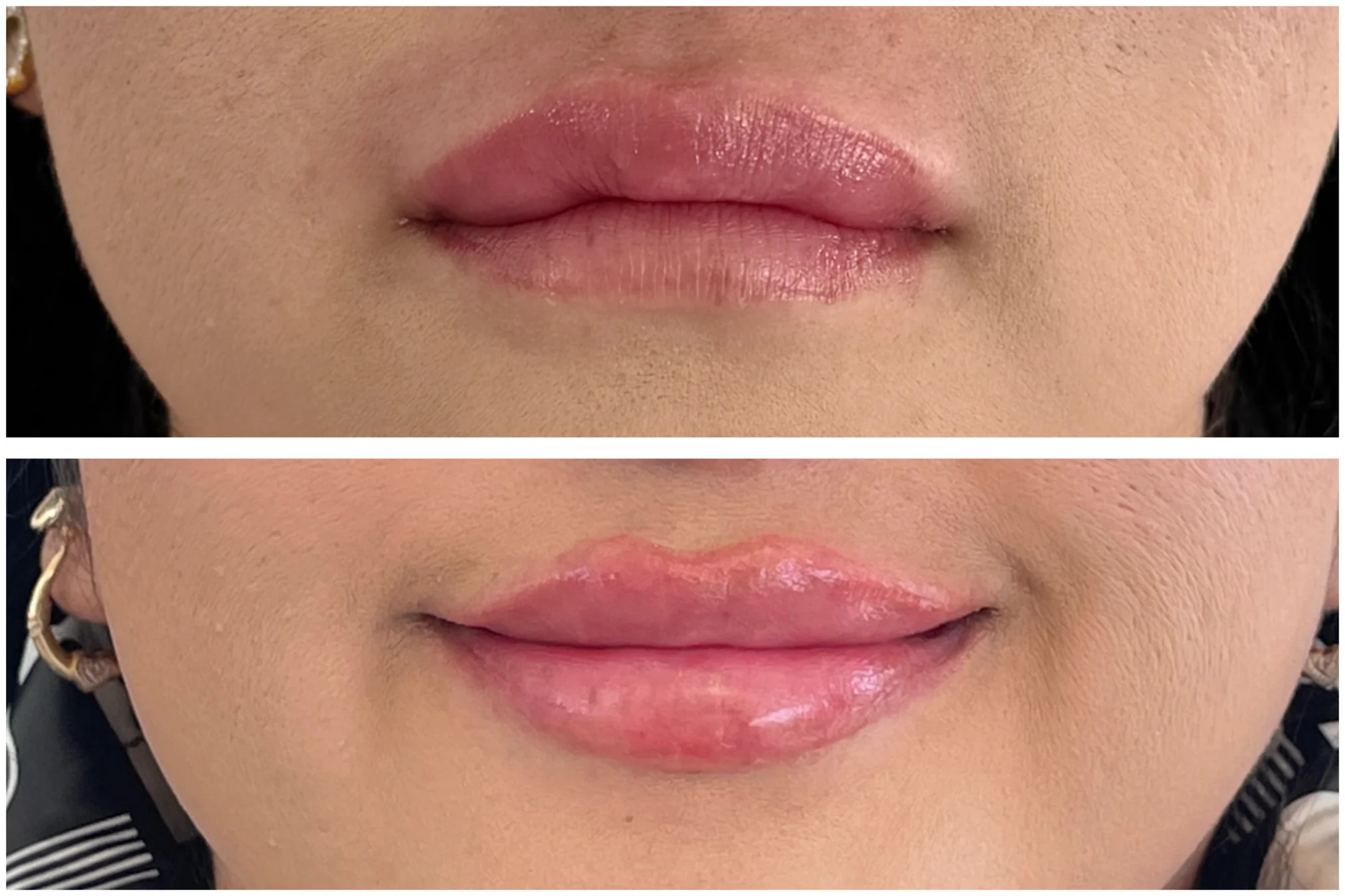 Resultados antes y después de Corrección de Tratamientos en Avoria